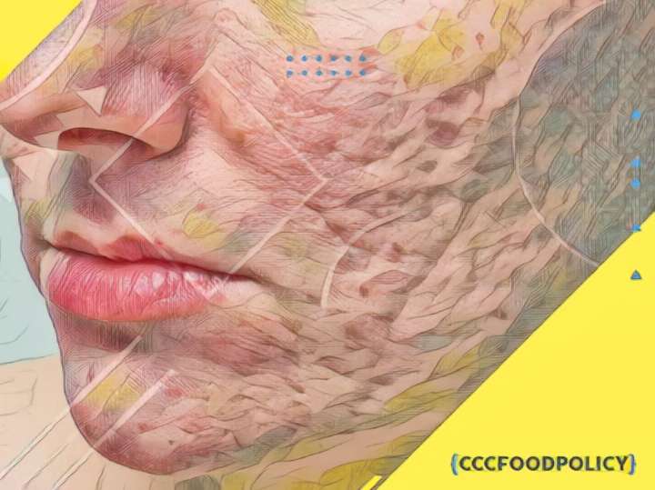 eliminați cicatrici