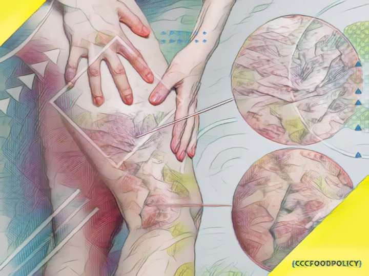 De ce avem vene varicoase doar pe un picior