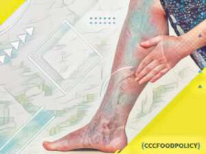 creme pentru vene varicoase